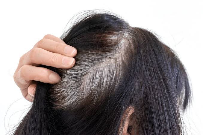 白髪は何故生えるのか⁈
