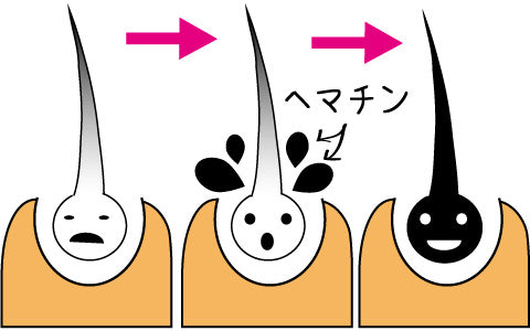 💫ヘマチン未知なる力💫